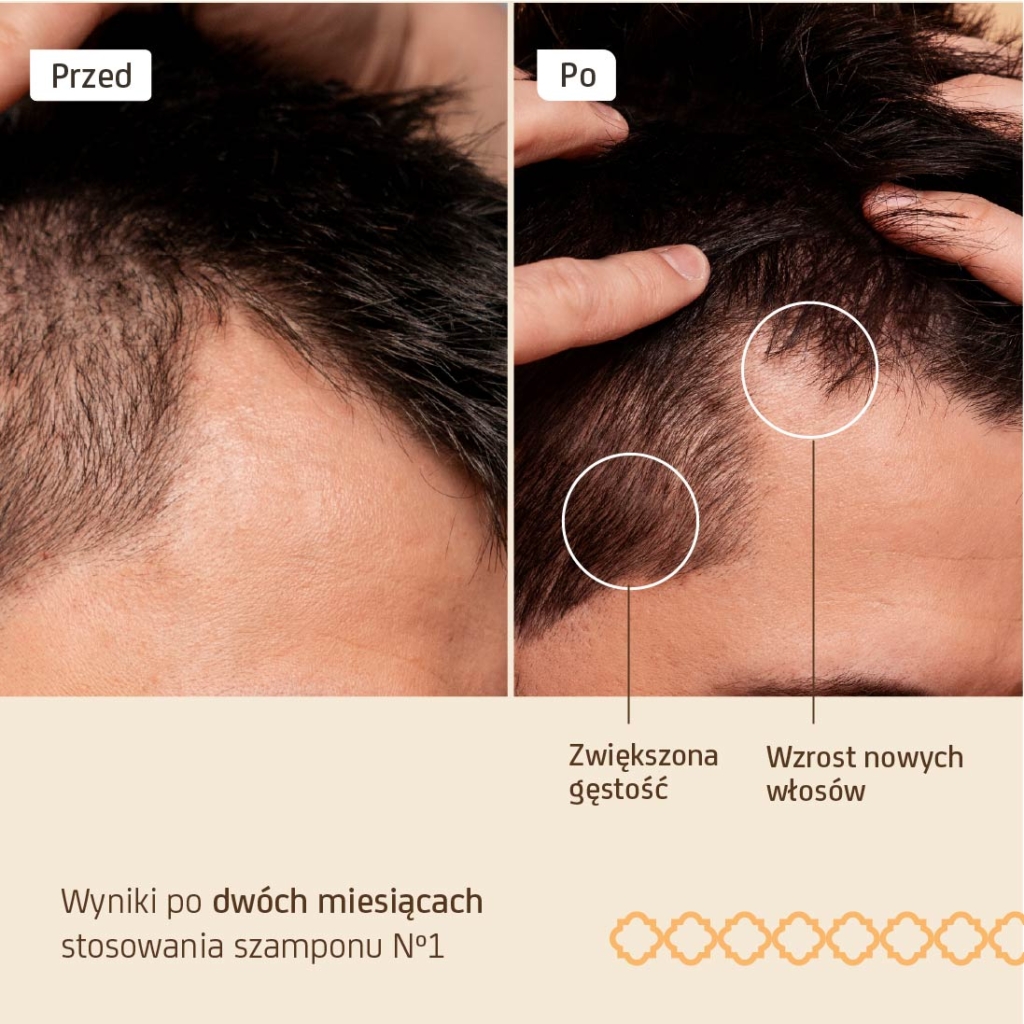 Szampon odżywczy Nº1 Strength & Volume