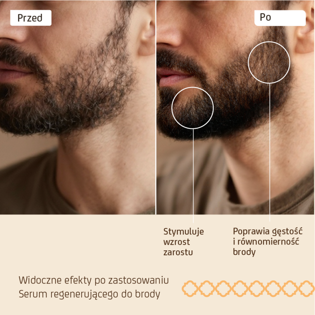 Treatment effects